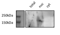DCL1 | Dicer-like protein 1 in the group Antibodies Plant/Algal  / DNA/RNA/Cell Cycle / microRNA at Agrisera AB (Antibodies for research) (AS19 4307)